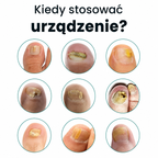 DermalPulse™ — Nail Fungus Treatment Solution
