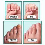 DermalPulse™ — Nail Fungus Treatment Solution