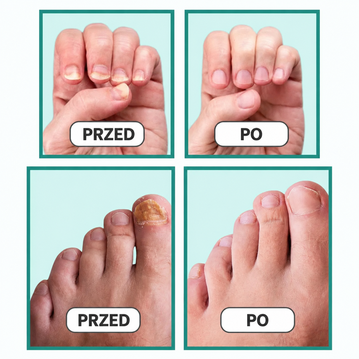 DermalPulse™ — Nail Fungus Treatment Solution